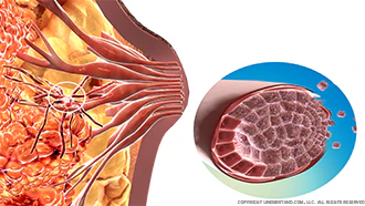 breast cancer images